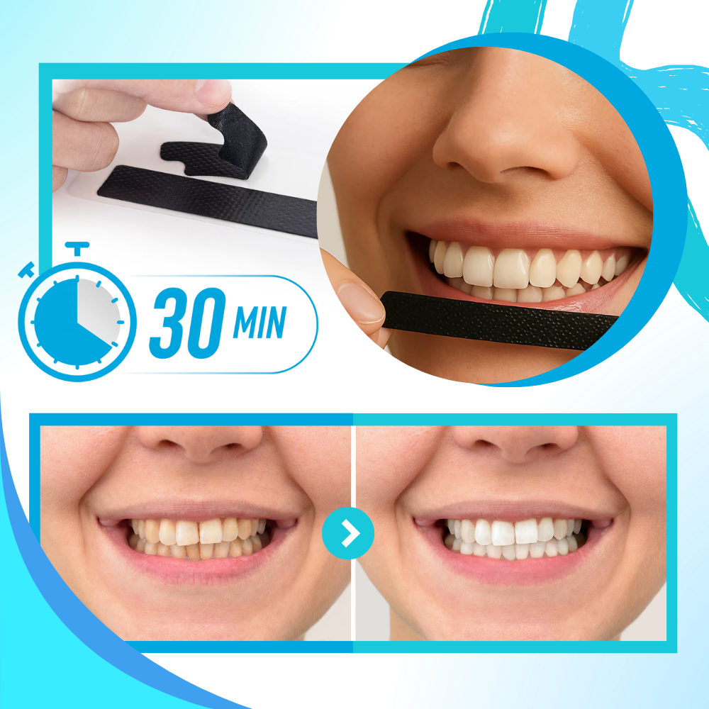 Minty Charcoal Teeth Strips - Ozerty