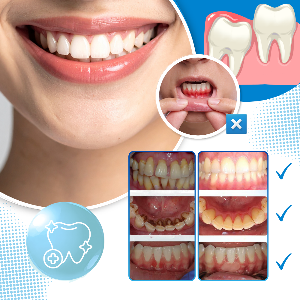 Refreshing White Dental Drops Mouthwash - Ozerty