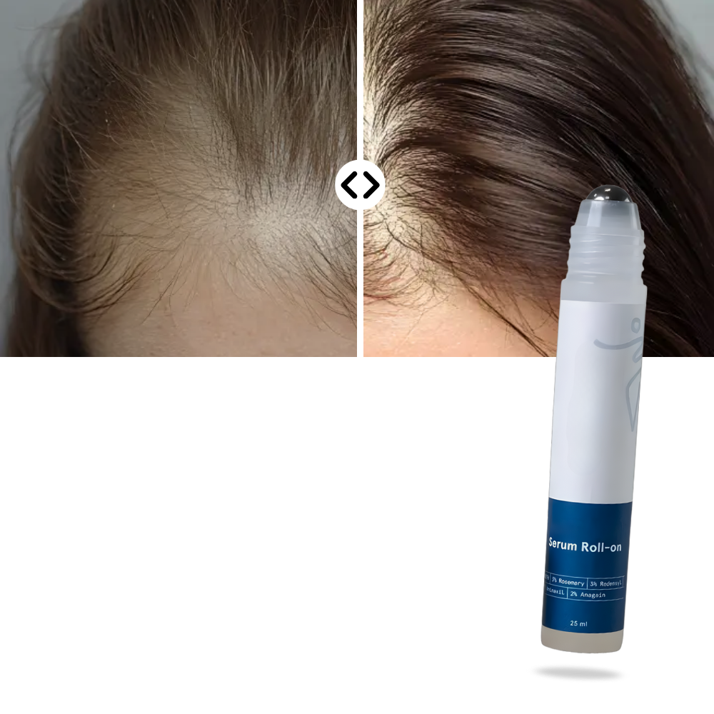 Scalp Nourishing Roll-On Serum - Ozerty
