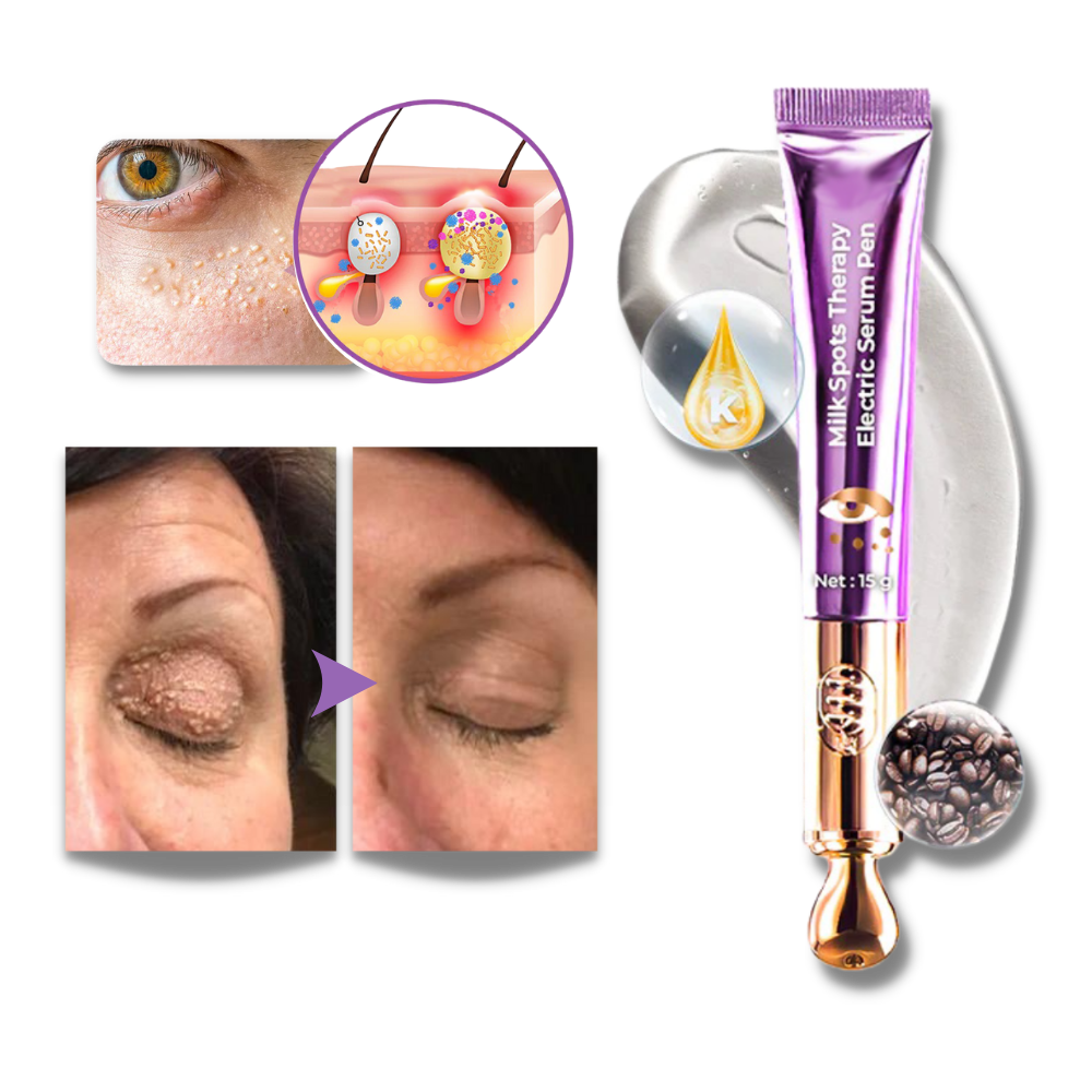 Vibrating Eye Firming Cream Device - Ozerty