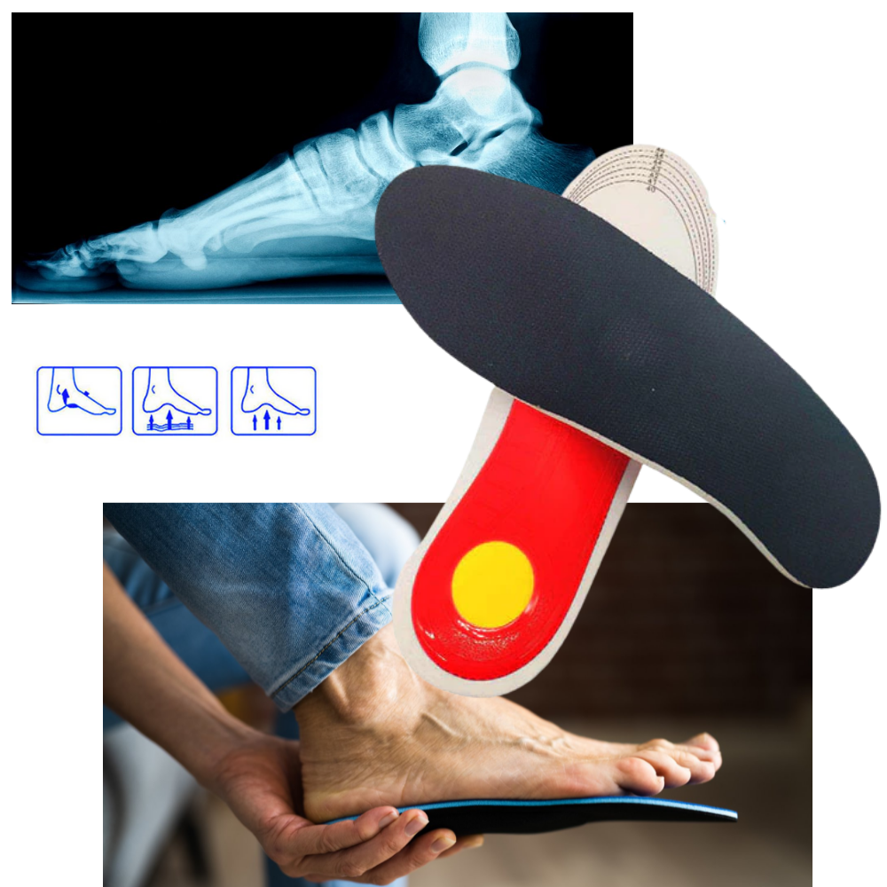 Flat feet 2025 and arch support