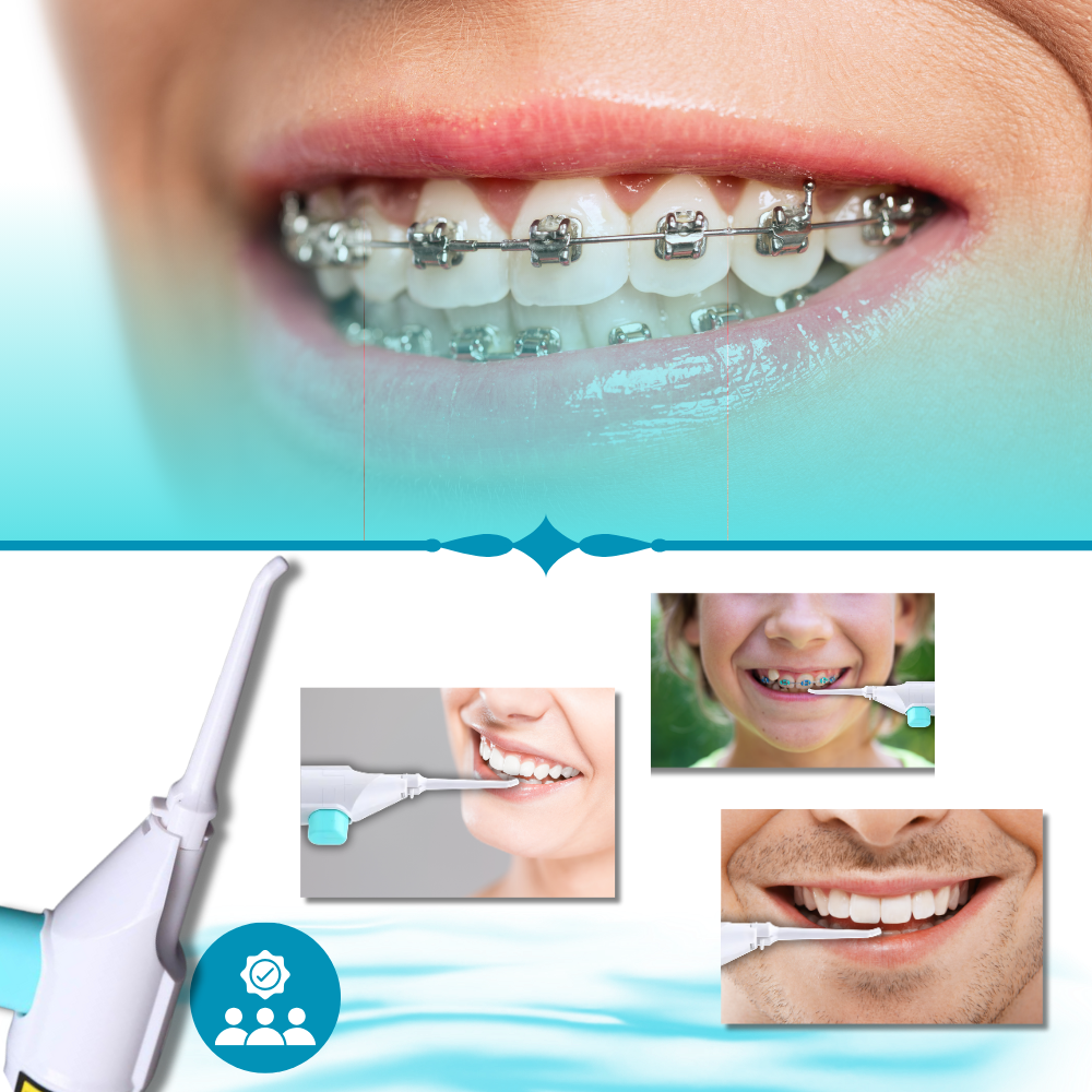 Air Powered Teeth Water Flosser - Ozerty