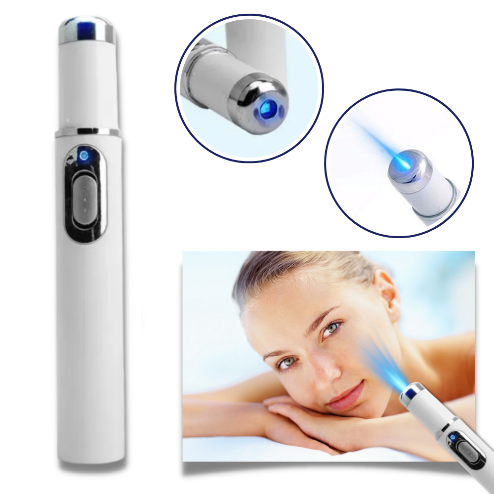  Dark Spot Remover Blue Laser Pen - Ozerty