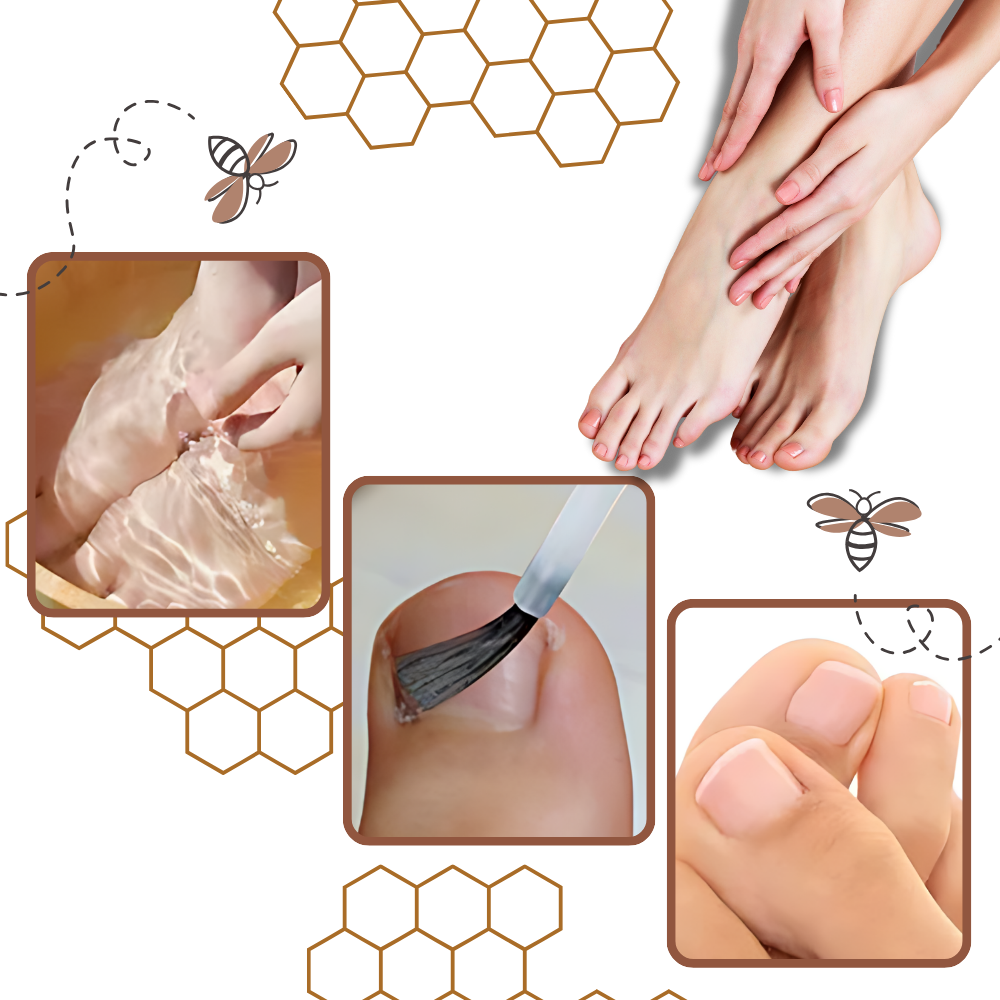 Fast Acting Toenail Fungus Treatment - Ozerty