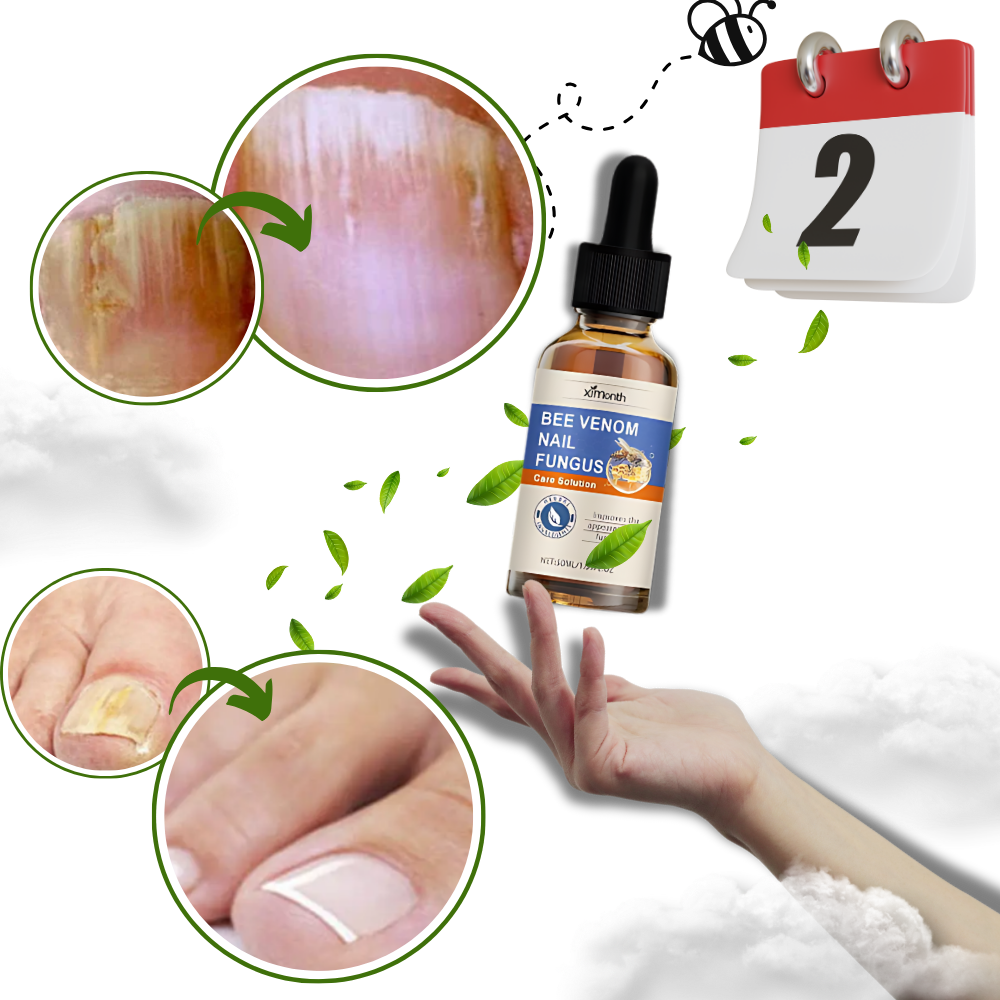 Fast Acting Relief Nail Fungal Drops - Ozerty