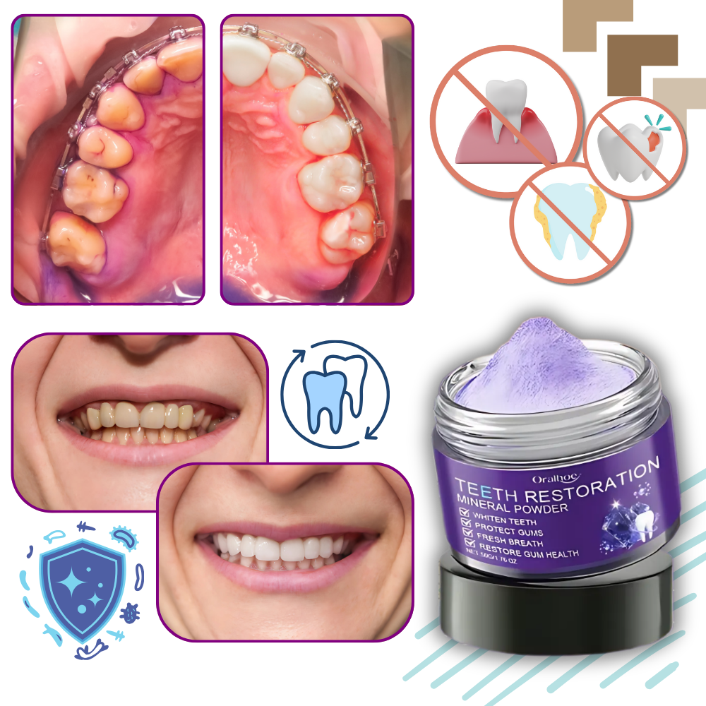 Fresh Boost Purple Teeth Whitening - Ozerty