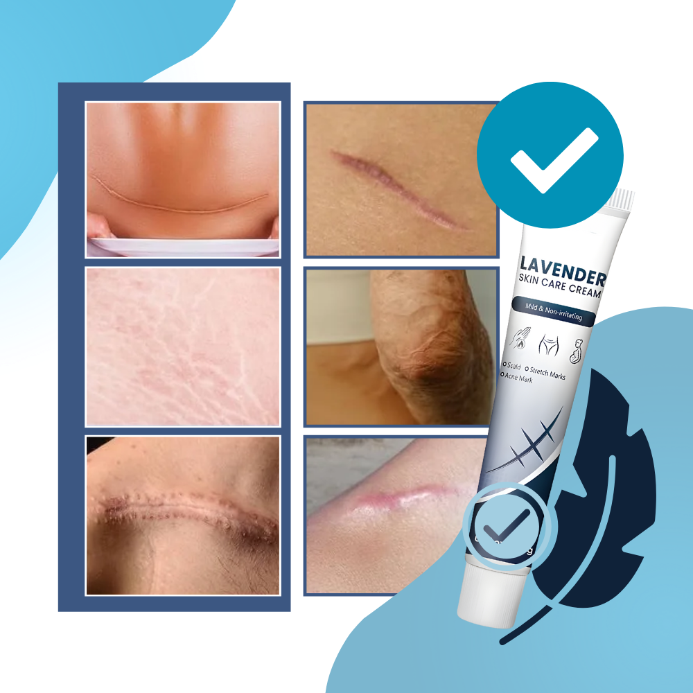 Scar Hydrating Silicone Cream - Ozerty