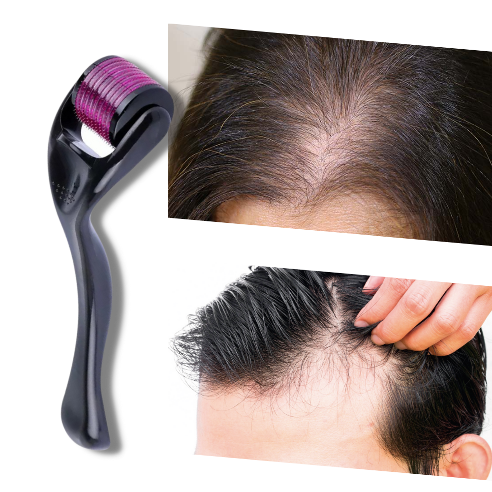 Derma roller for hair and beard growth