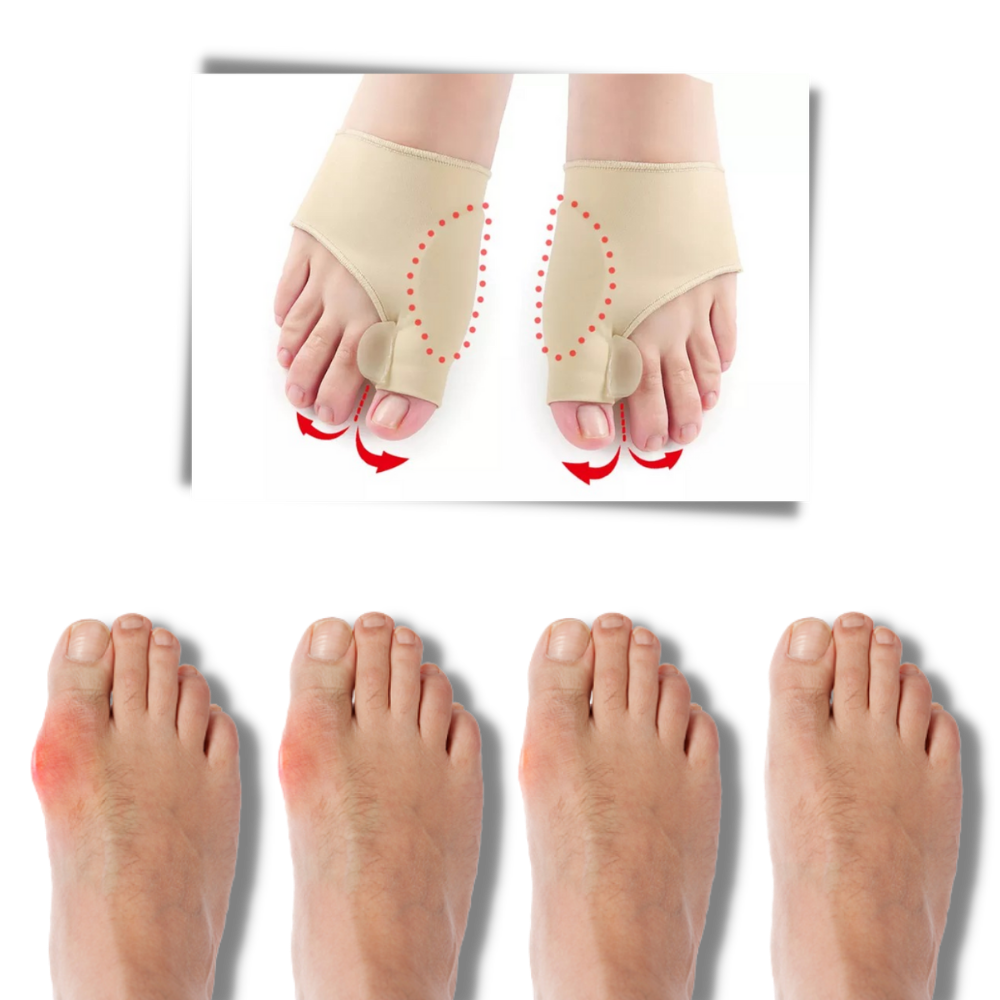 Gel bunion corrector