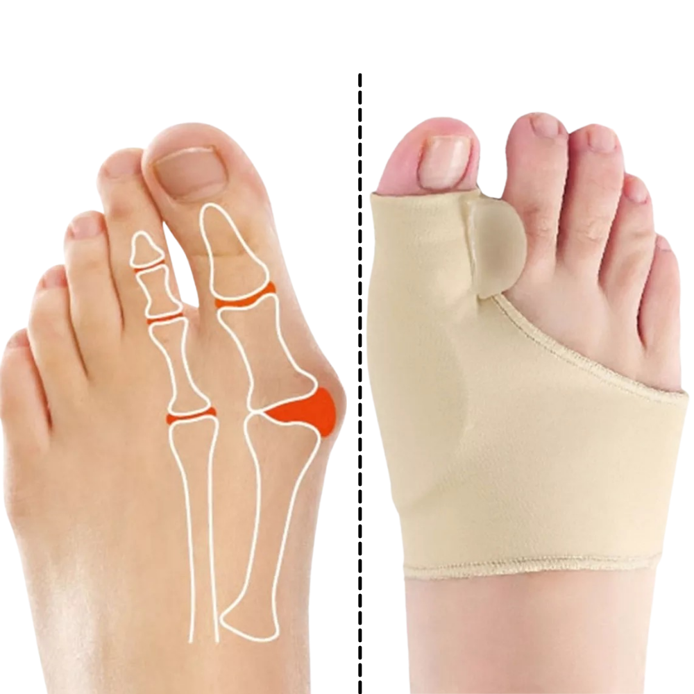 Gel bunion corrector