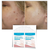 Skin tag removal treatment patch